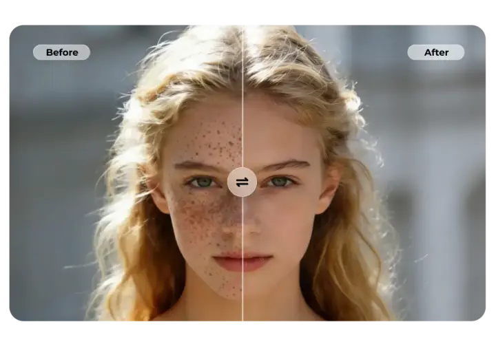 Split image of a young woman's face. Left side shows freckles, right side is smooth.