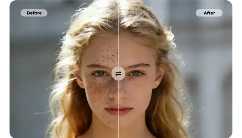 Split image of a young woman's face. Left side shows freckles, right side is smooth.