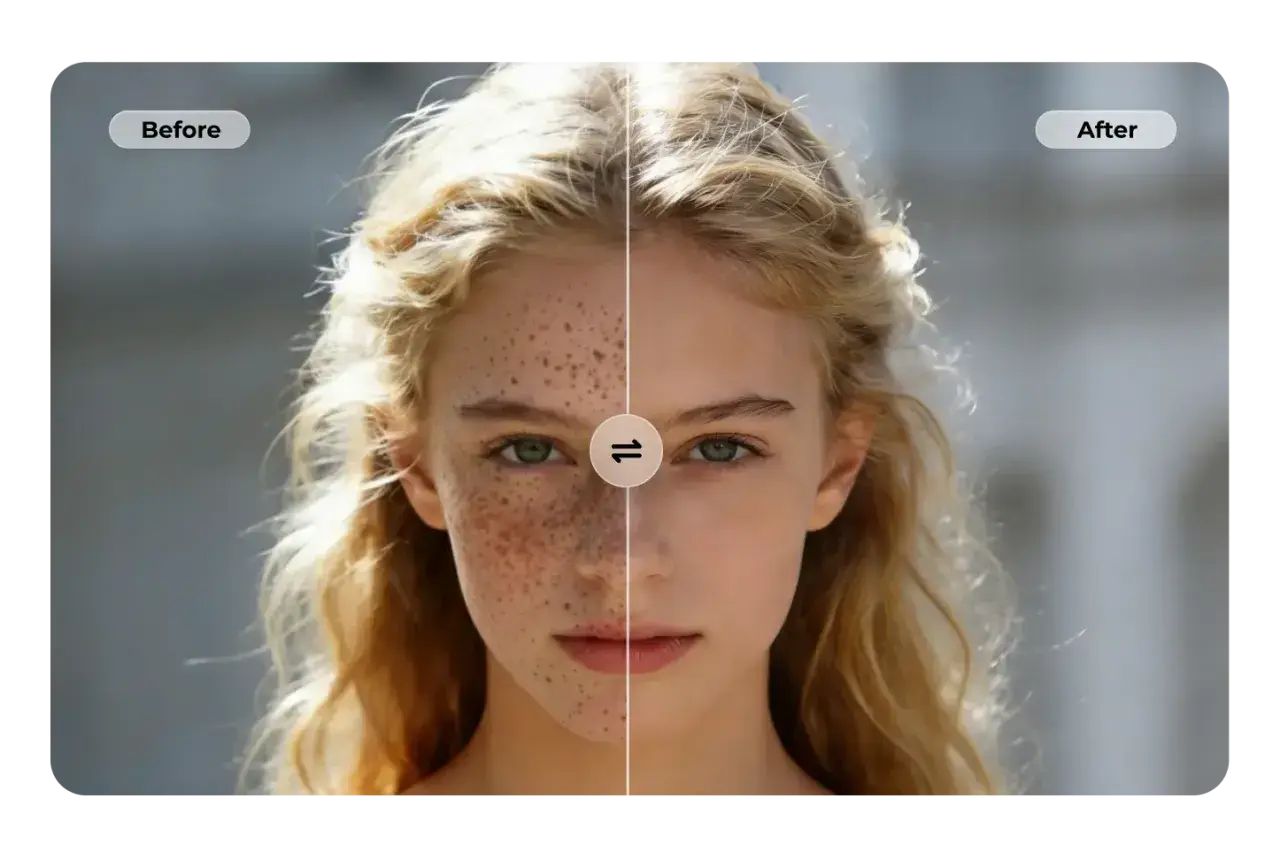 Split image of a young woman's face. Left side shows freckles, right side is smooth.